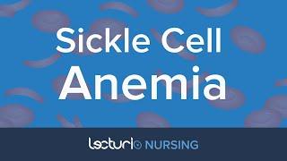 Sickle Cell Anemia | Pediatric Nursing | NCLEX Prep