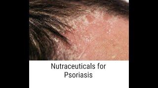 Nutraceuticals for Psoriasis