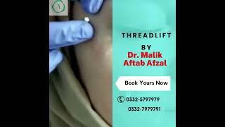 Thread Lift by Dr Aftab Afzal