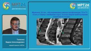 "МРТ в диагностике объемных образований позвоночника и спинного мозга"