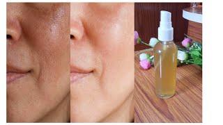 Diy Green Tea Toner ||Magical Diy Toner for acne pimple open pores|#shorts #viral #diy