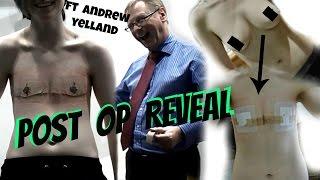 Post Op Reveal || Non-Binary Top Surgery with Andrew Yelland