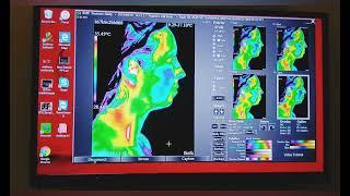 Thermal Imaging Test - Cell Phone & products from EMF Solutions