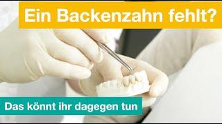 Ein Backenzahn fehlt - was tun?