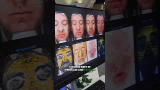 Dermatologist takes an age test: Does my skin make me look older or younger? #dermatologist #visia