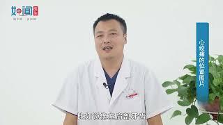 【心血管内科】心绞痛的位置图片