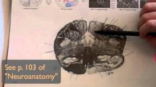 Dorsal Column medial lemniscus pathway