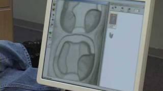 Cerec CAD/CAM Single Visit Dentistry in Denville, NJ