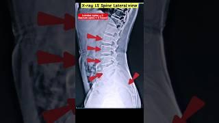 L-S Spine X-ray #shorts #xray #radiographerusn #radiography