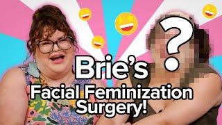 Brie Got Facial Feminization Surgery! | Kitchen & Jorn