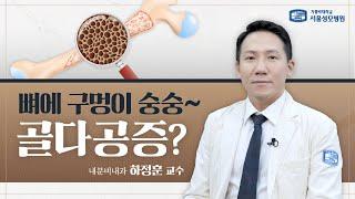 뼈에 구멍이 숭숭~ 골다공증? | 서울성모병원 하정훈 교수