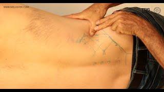 Trigger Point Release for Back Pain: Quadratus Lumborum (QL)