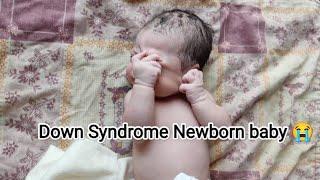 Cutest Down Syndrome newborn baby getting dressed up just after birth #cute #love #usa