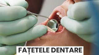 Fatetele dentare, intre avantaje si dezavantaje - Dr Fondrea