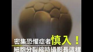 密集恐懼症者慎入！ 細胞分裂縮時攝影長這樣 | 台灣蘋果日報