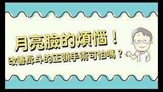 月亮臉的煩惱，正顎手術可怕嗎？