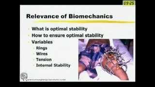 Biomechanics of Ilizarov Fixator