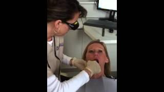 Oral cancer screening