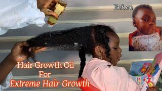 overnight hair growth oil for fast and extreme hair growth #hairgrowthoil #howto