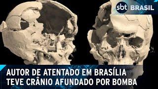 Bomba explode próximo da cabeça e afundou crânio do autor de atentado no STF | SBT Brasil (18/11/24)