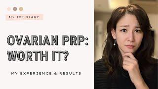 My experience getting Ovarian PRP – Does it really work? Ovarian Rejuvenation for DOR and POI #IVF