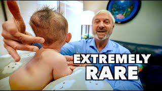 EXTREMELY RARE CRANIOSYNOSTOSIS! | Dr. Paul