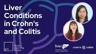 Liver Conditions in Crohn's and Colitis