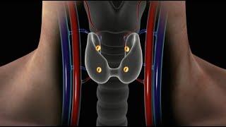 Overview of Parathyroid Disease (Causes, Symptoms and Treatment for Hyperparathyroidism)