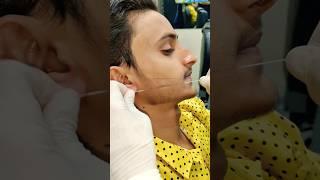 Beard Line Style ASMR  #adi #skincare #beardshape #youtube