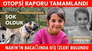 Narin Güran'ı Köpek Isırmış - Göğsündeki ve Boynundaki İzler Neden Oldu?