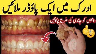 In 2 minutes, the yellow color will make dirty teeth  white and shiny | Remedy for teeth whitening