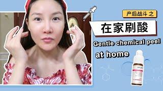 Gentle Chemical Peel at Home | 产后战斗之：在家刷刷酸