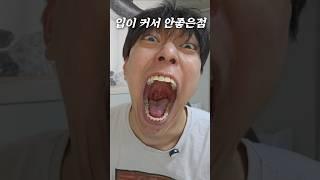 입이 커서 안좋은점