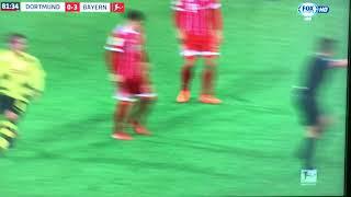 Tobias Stieler injury - Borussia Dortmund Bayern Munchen 1-3 - 2017