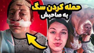 سگ ها به صاحبشون حمله میکنند؟  دلیل هایی که باعث حمله سگ ها میشه