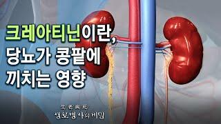 크레아티닌이란, 당뇨가 콩팥에 끼치는 영향 - 증상이 나타나면 늦는다, 콩팥병의 진실 (KBS_767회_20210310)