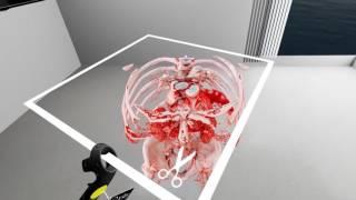 Virtual Reality in Medicine: New Opportunities for Diagnostics and Surgical Planning