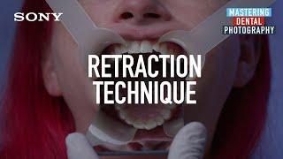 Dental Photography: Retraction Technique