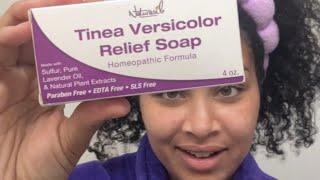 Naturasil TINEA VERSICOLOR relief soap REVIEW!