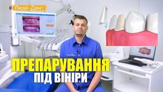 Препарування під вініри Київ (Відео) Люмі-Дент