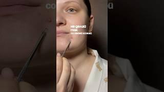 Ухаживай за кожей правильноарт.WB на кислотный пилинг #223462032 #пилинглица #прыщиналице