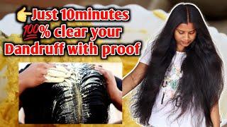 10 minutes dandruff clear challenge||உங்க பொடுகு தொல்லைக்கு முற்றுப்புள்ளி வைக்கலாம்