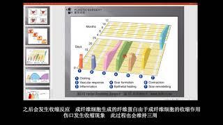 [H整形医院] 关于面部轮廓手术副作用