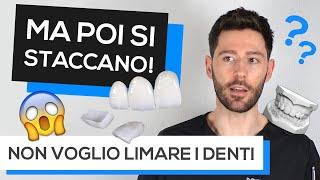 Faccette dentali: cosa sono?