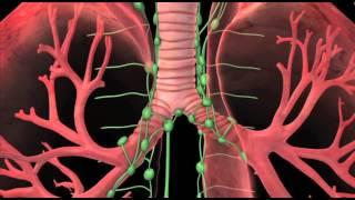 Florida Hospital Cancer Institute-Kissimmee: Dr. David Robinson on Lung Cancer Treatment