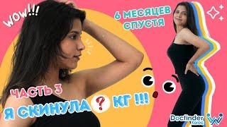 Я похудела на ?? кг после Липосакции всего тела в Корее! | Есть ли шрамы после Ринопластики? Часть 3