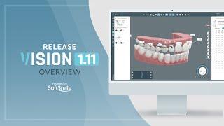 Release 1.11 Vision: New Features Overview
