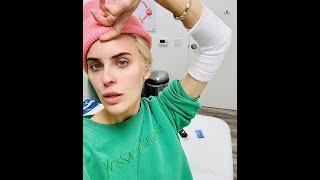 Tallulah Willis Shares BTS of Painful Tattoo Removal