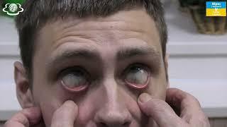 Голодні очі!