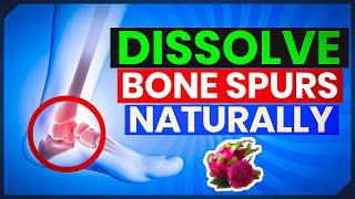 Natural Solutions: How to Dissolve Bone Spurs Without Surgery